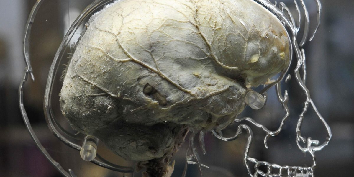 A real human brain suspended in liquid with a to-scale skeleton, central nervous system and human silhouette carved into acrylic, inside the @Bristol science attraction as part new exhibition called 'All About Us' which will open to the public on Friday 11th March.